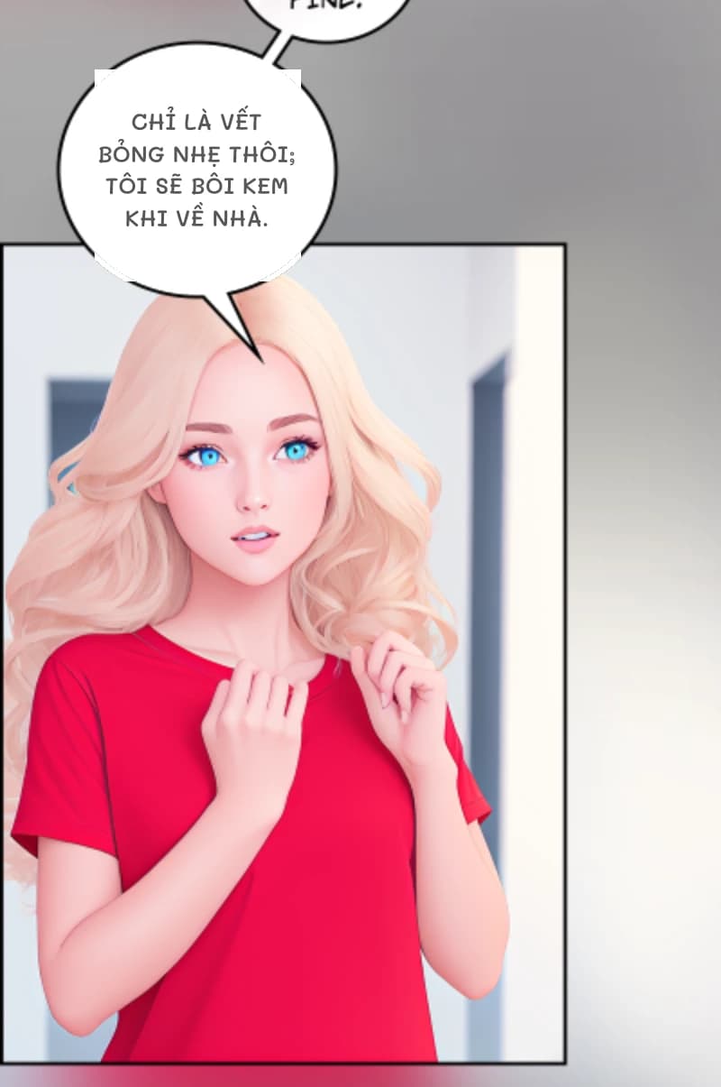 Chỉ là vết bỏng nhẹ thôi; tôi sẽ bôi kem khi về nhà.