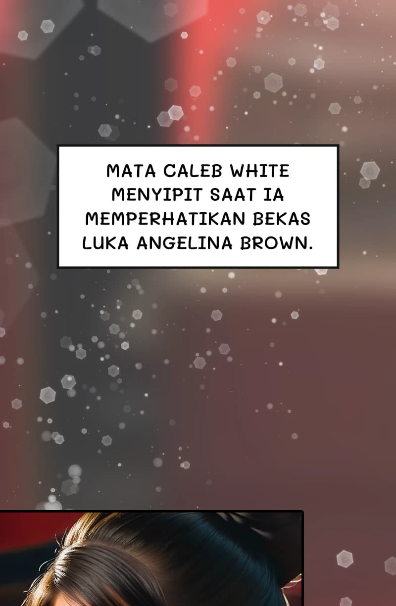 Mata Caleb White menyipit saat ia memperhatikan bekas luka Angelina Brown.